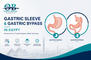 Gastric sleeve and gastric bypass surgery in Egypt