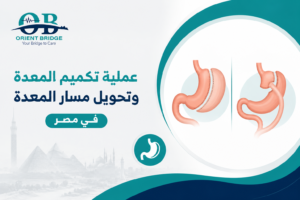عملية تكميم المعدة وتحويل مسار المعدة في مصر – خدمات السياحة العلاجية من اورينت بريدج.