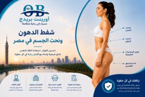 شفط الدهون ونحت الجسم في مصر لتحديد الخصر والبطن وتنسيق الفخذين مع أورينت بريدج